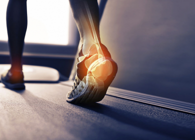 Plantar Fasciitis: What Is It? What To Do About It?