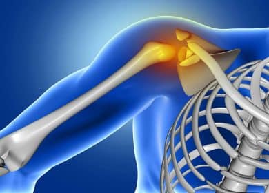 Frozen Shoulder: What You Need to Know and How to Thaw It
